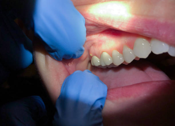 Best Tooth Infection Emergency Dentist  in North Olmsted, OH