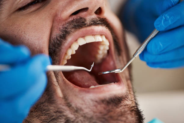 Best Dentist for Tooth Abscess  in North Olmsted, OH