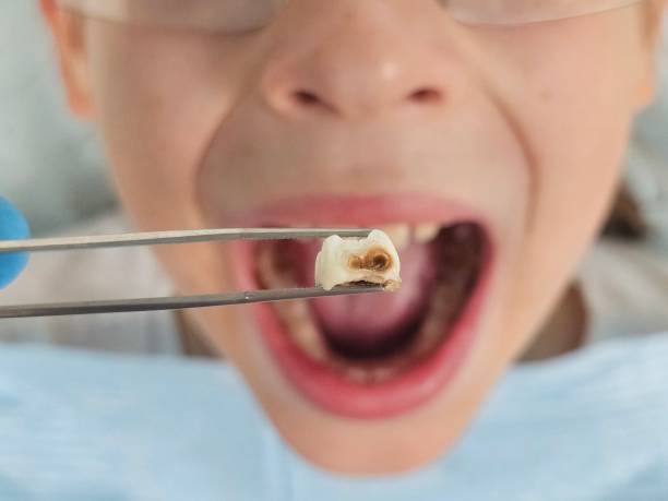 Best Emergency Gum Pain Relief  in North Olmsted, OH