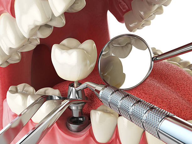 Best Urgent Tooth Repair  in North Olmsted, OH