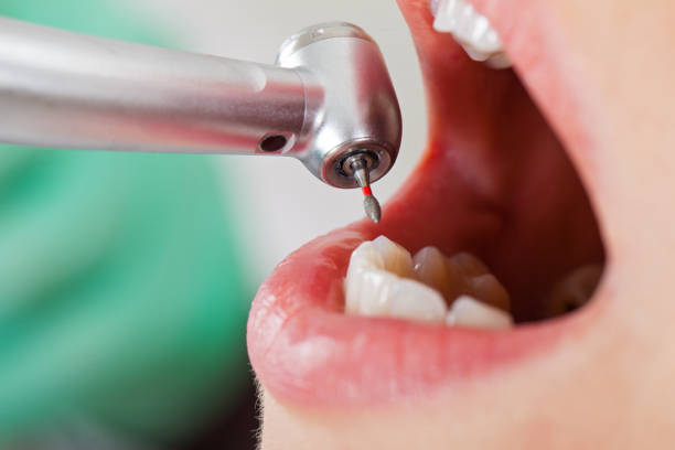 Best Knocked-Out Tooth Emergency  in North Olmsted, OH